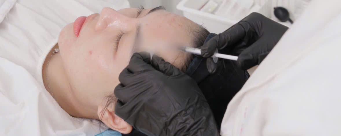 Tinh chỉnh đường nét