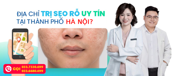 dieu-tri-seo-ro-o-ha-noi