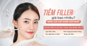 chi phí tiêm filler