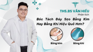 Tách sẹo bằng kim hay khí tốt hơn
